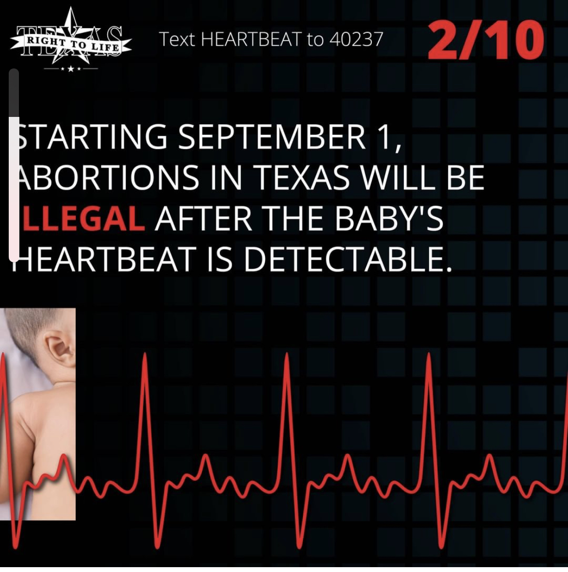 Starting September 1, abortions in Texas will be illegal once a fetal heartbeat is detected